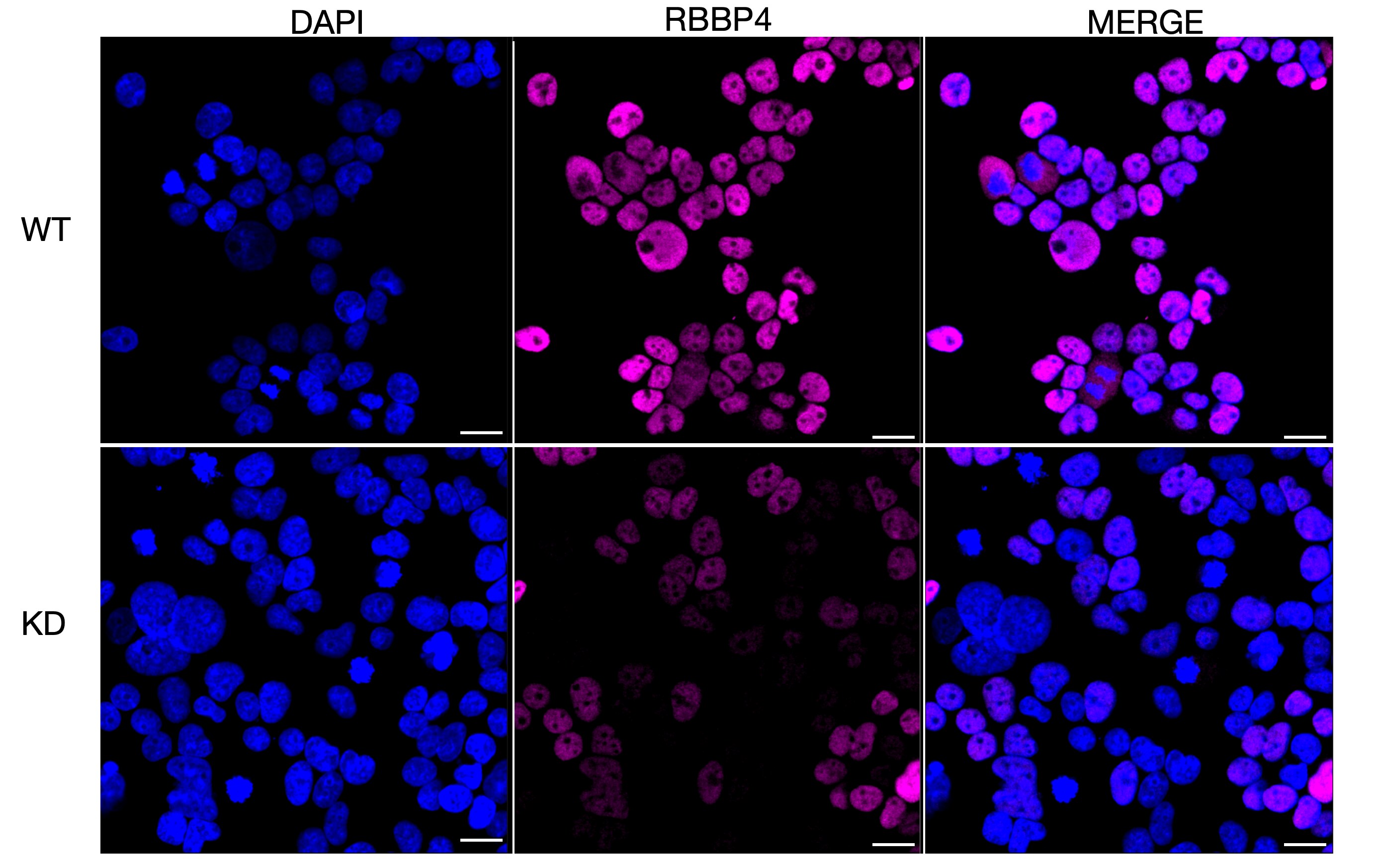 RBBP4/RbAp48 Antibody (24GB1240)