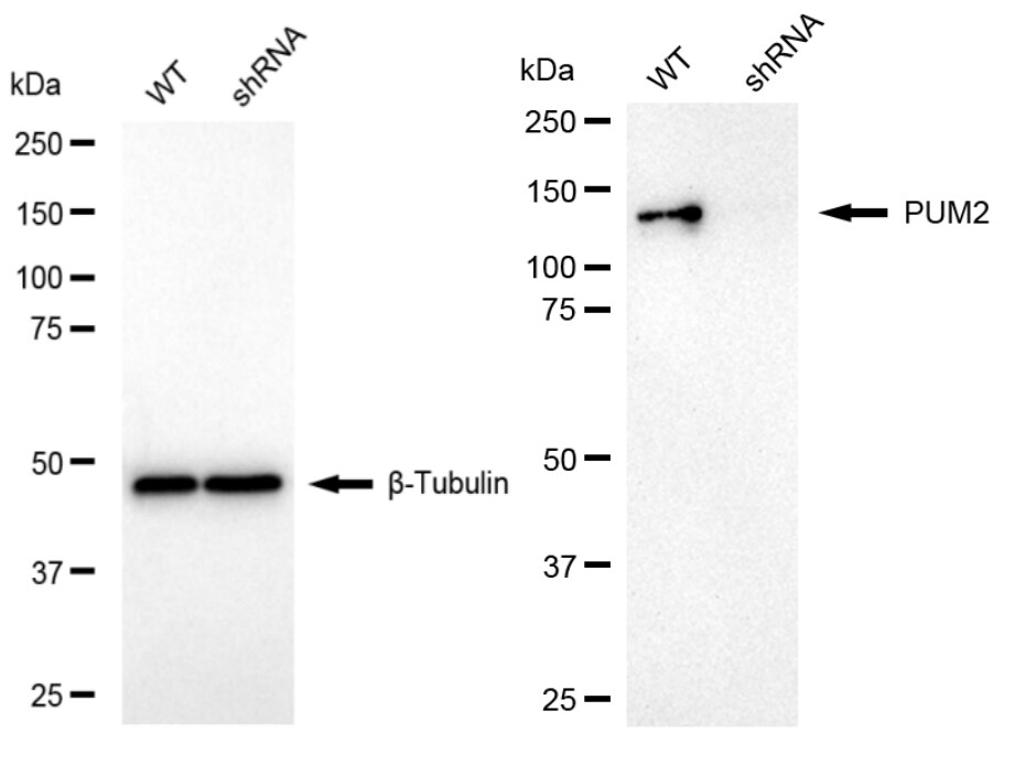 PUM2 Antibody (24GB1250)
