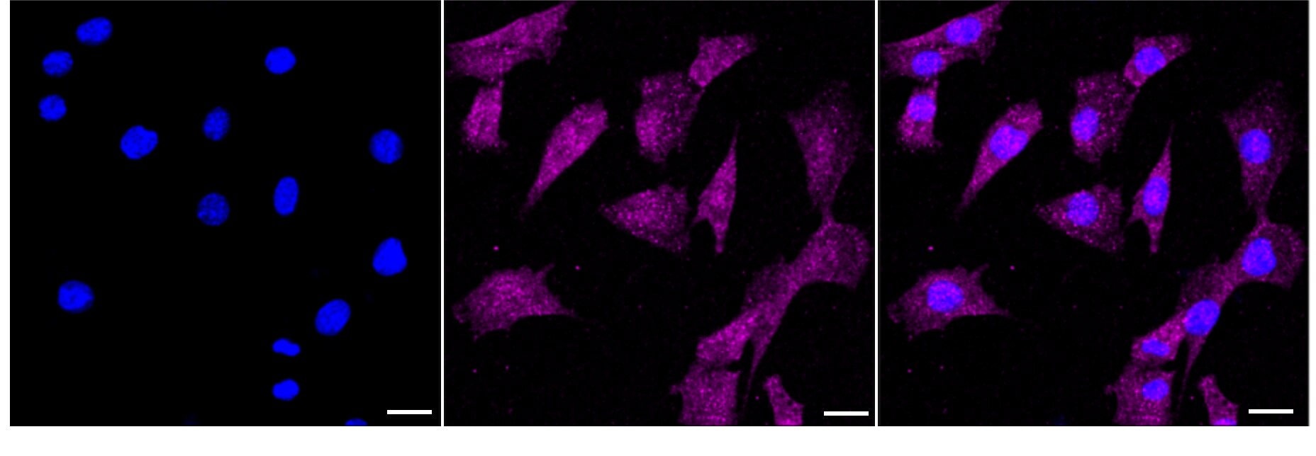 ERK2 Antibody (24GB3095)