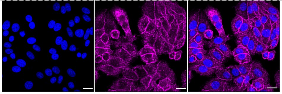 Radixin Antibody (24GB1420)
