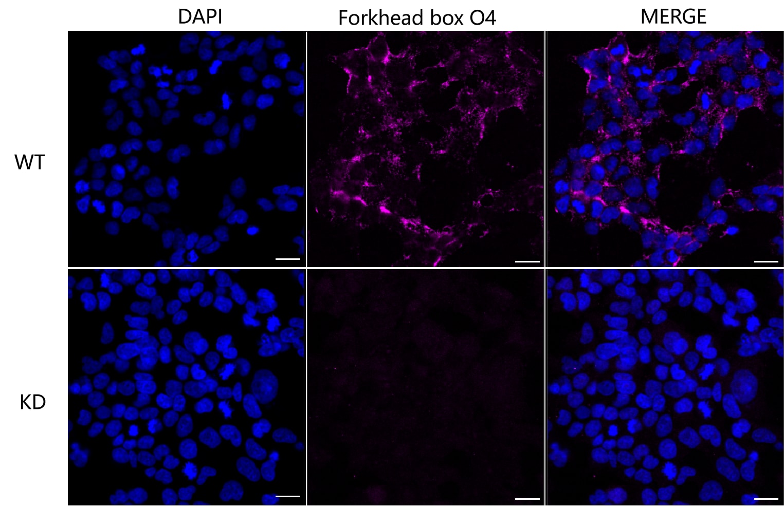 FOXO4 Antibody (23GB1470)