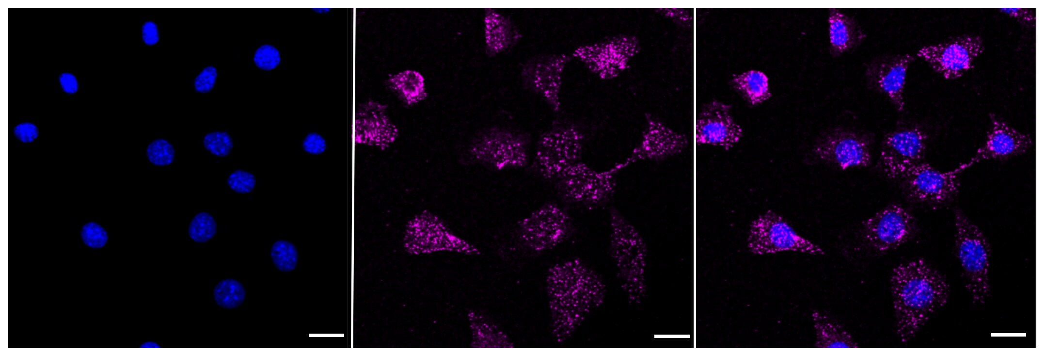FOXO4 Antibody (23GB1470)