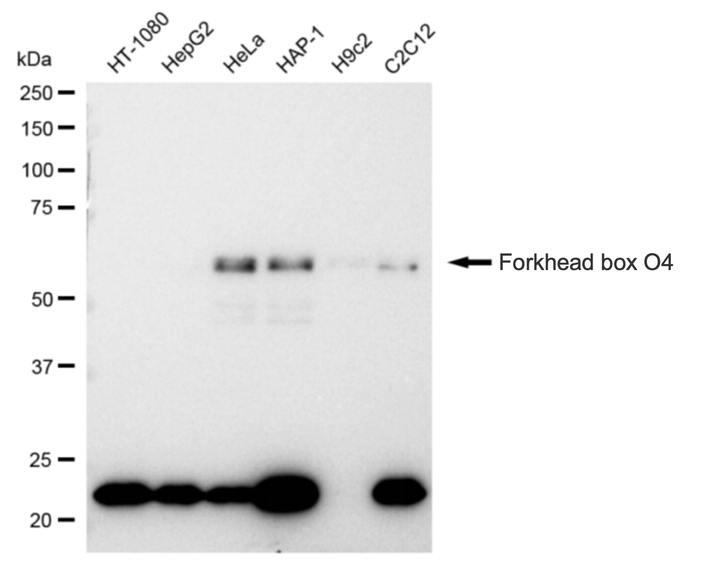 FOXO4 Antibody (23GB1470)