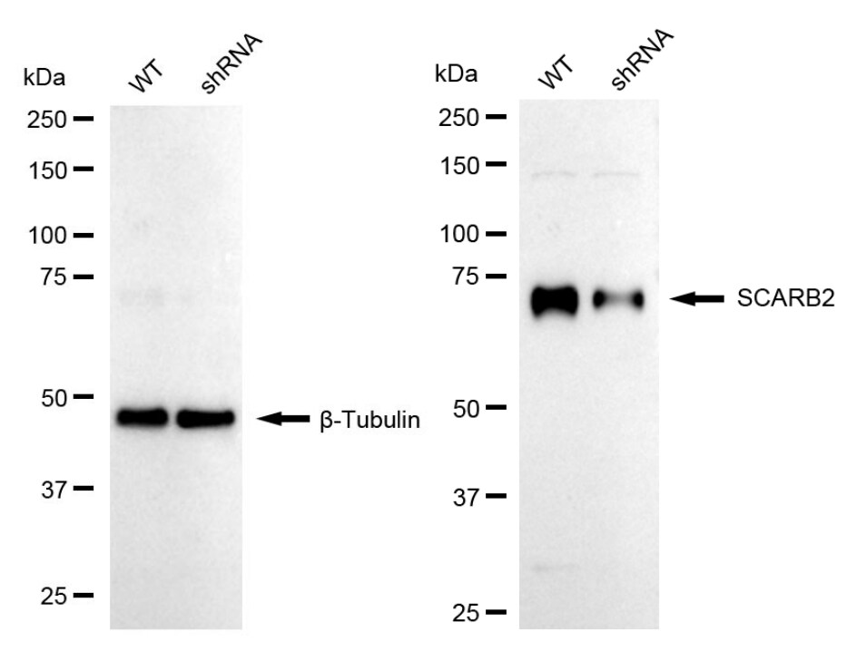 LIMPII/SR-B2 Antibody (24GB1520)