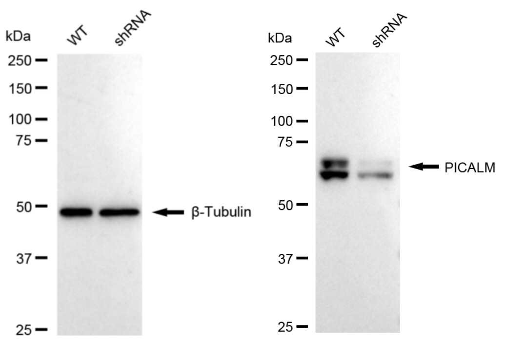 PICALM Antibody (24GB1620)