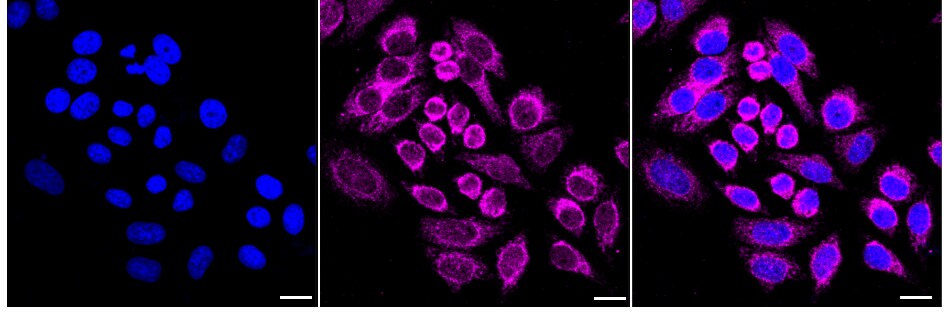 SLP-2 Antibody (24GB1870)