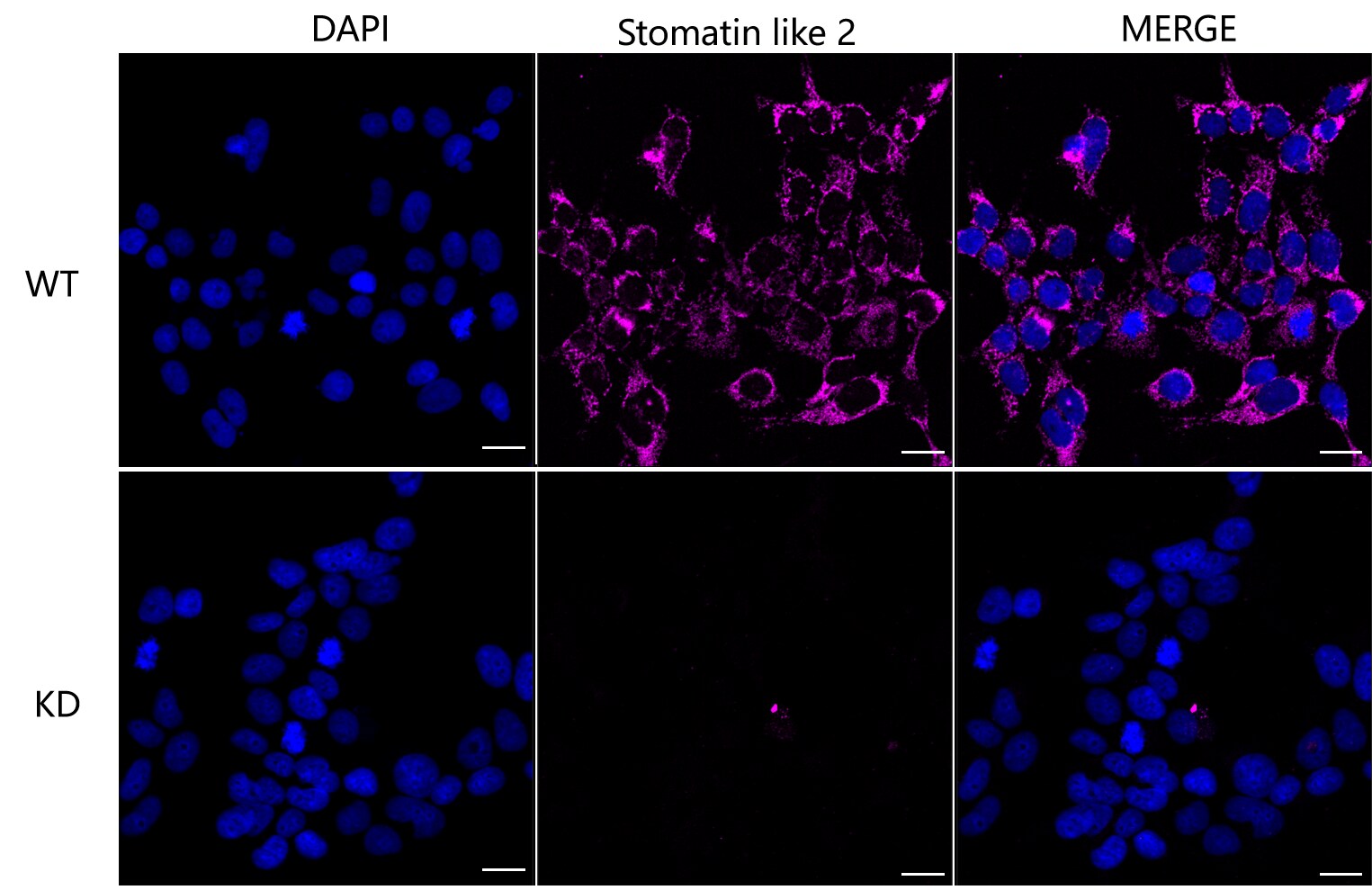 SLP-2 Antibody (24GB1870)