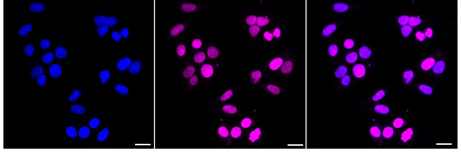 TOP2A Antibody (24GB1915)