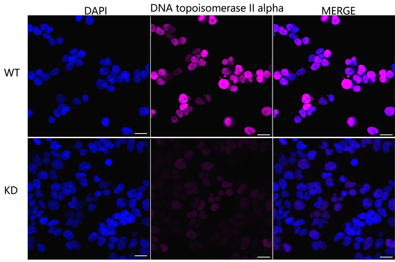TOP2A Antibody (24GB1915)