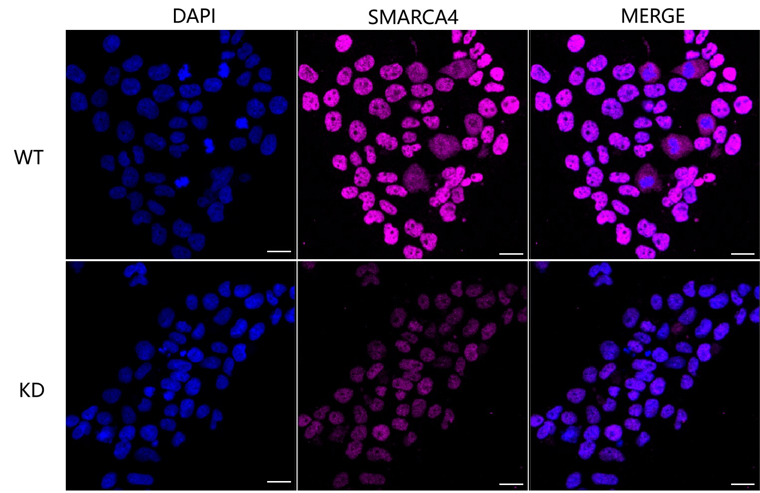 Brg1 Antibody (24GB2065)