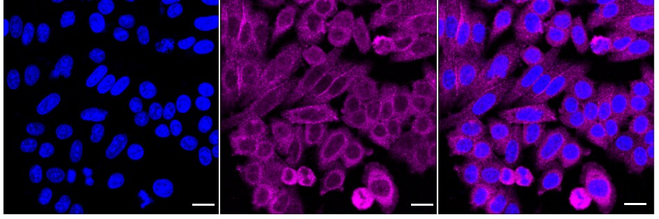 USP14 Antibody (24GB2190)