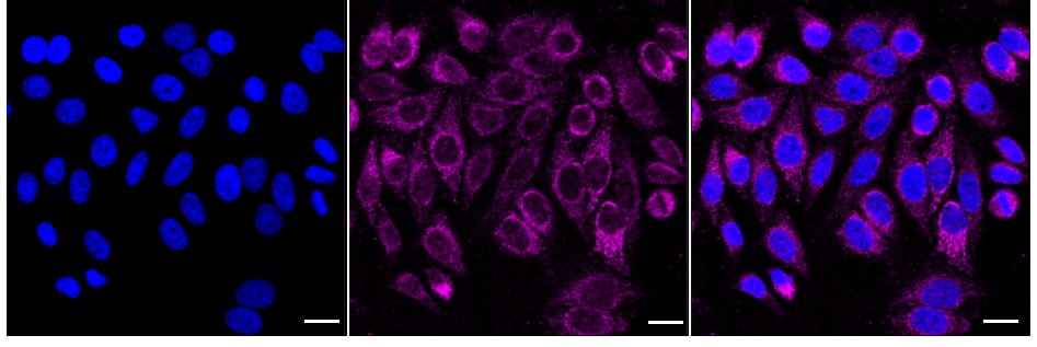 UQCRC2 Antibody (24GB2220)