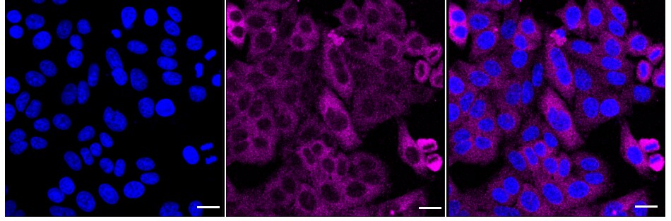 TRPM7 Antibody (24GB2250)