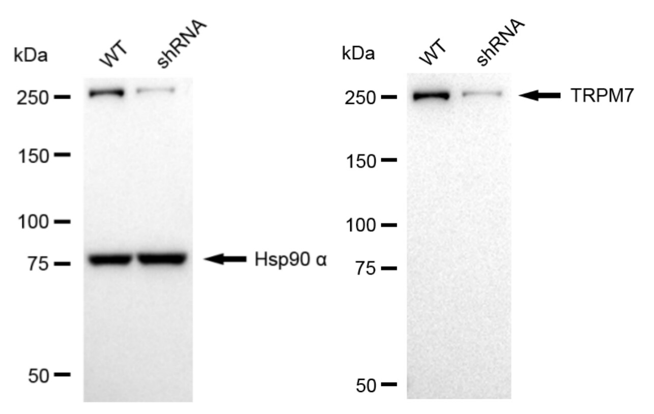 TRPM7 Antibody (24GB2250)