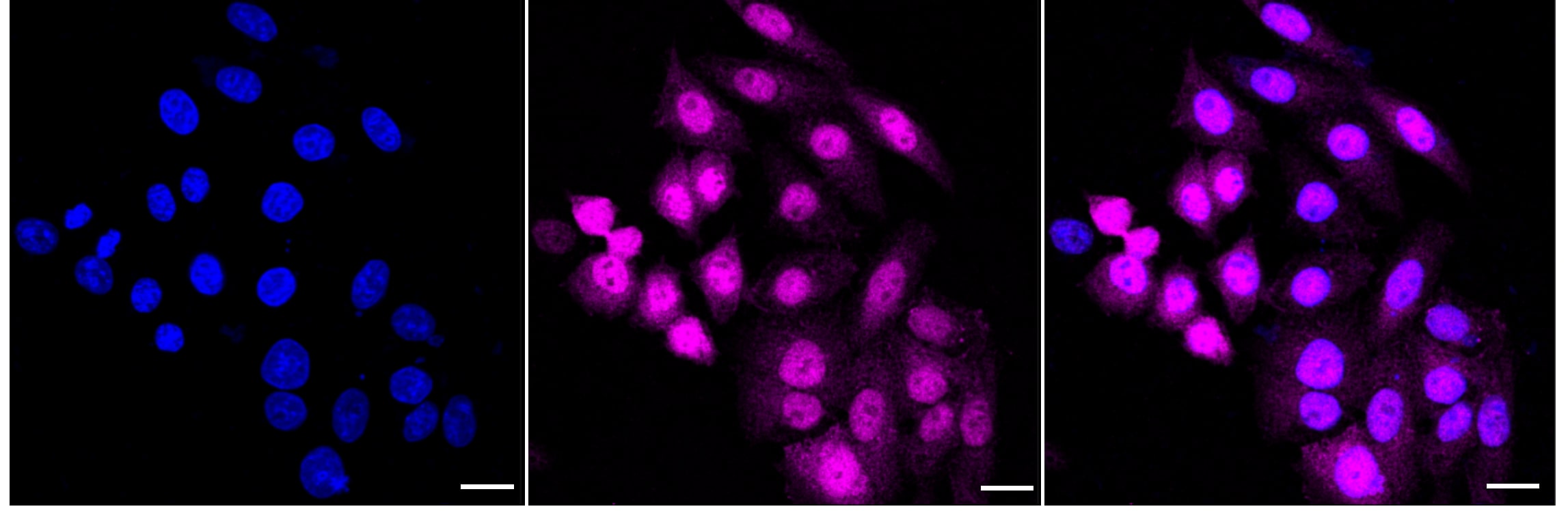 UBE4B Antibody (24GB1765)