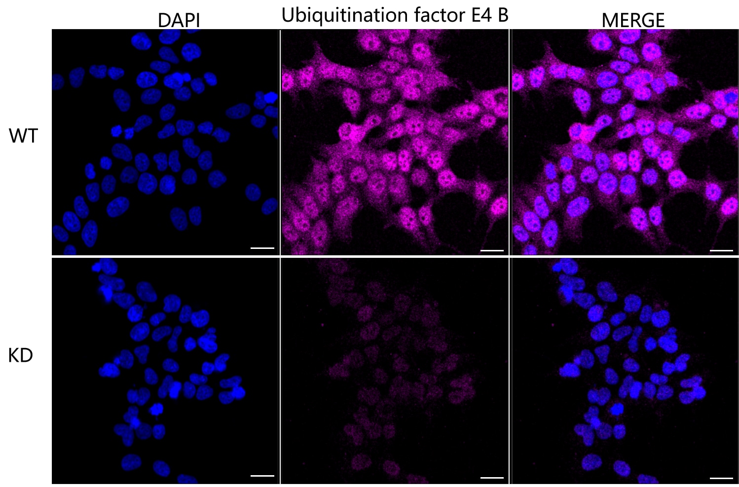 UBE4B Antibody (24GB1765)