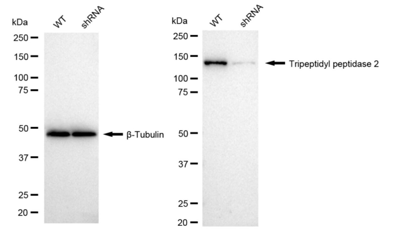 Tripeptidyl peptidase II Antibody (24GB2015)