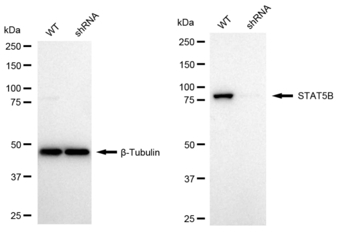 STAT5b Antibody (24GB2110)