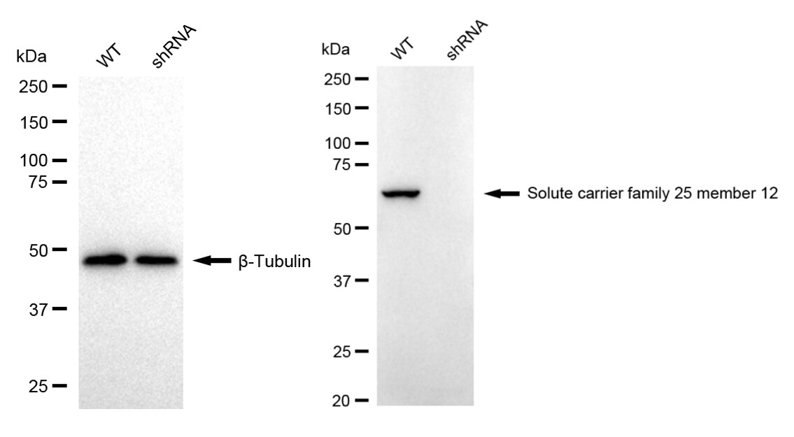 SLC25A12 Antibody (24GB2340)