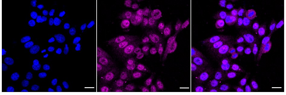 Serine racemase Antibody (24GB2345)