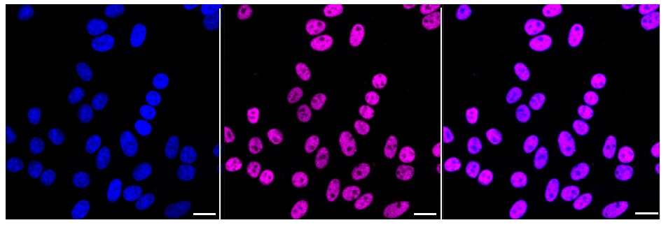 U2AF2 Antibody (24GB2465)