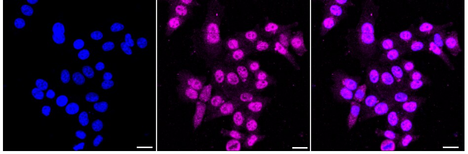 Tropomyosin-1 Antibody (24GB2545)