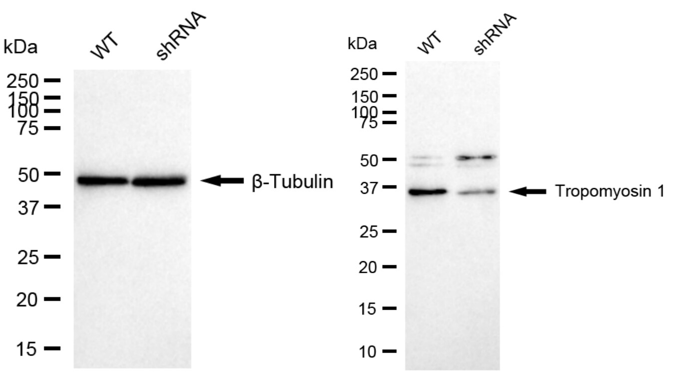 Tropomyosin-1 Antibody (24GB2545)