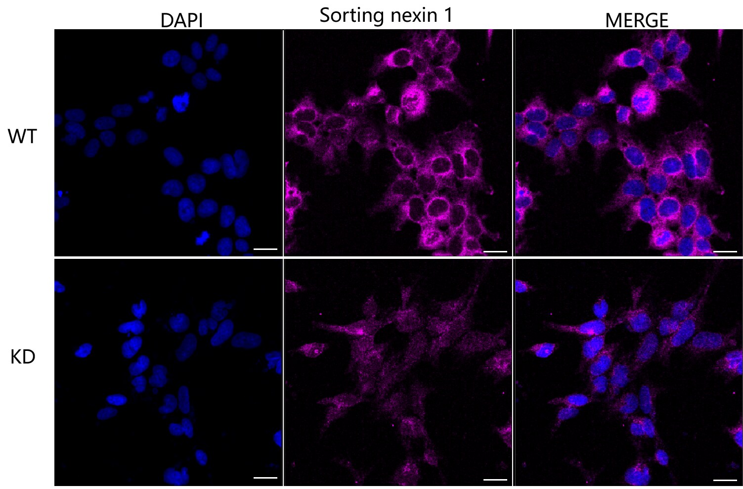SNX1 Antibody (24GB2595)