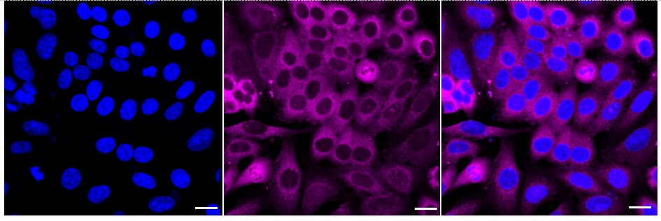 SNX1 Antibody (24GB2595)