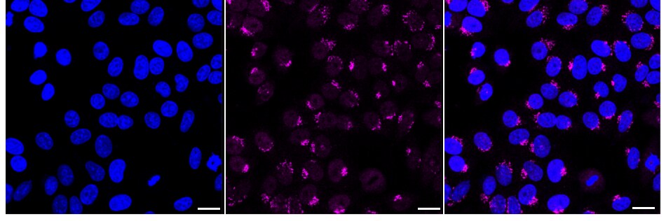 Somatostatin R5/SSTR5 Antibody (24GB2600)
