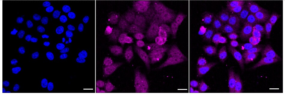 SMYD3 Antibody (24GB2260)