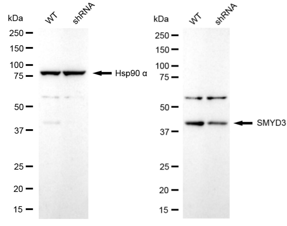 SMYD3 Antibody (24GB2260)