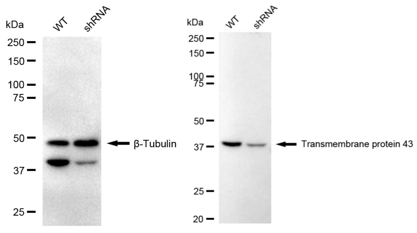 TMEM43 Antibody (24GB2325)
