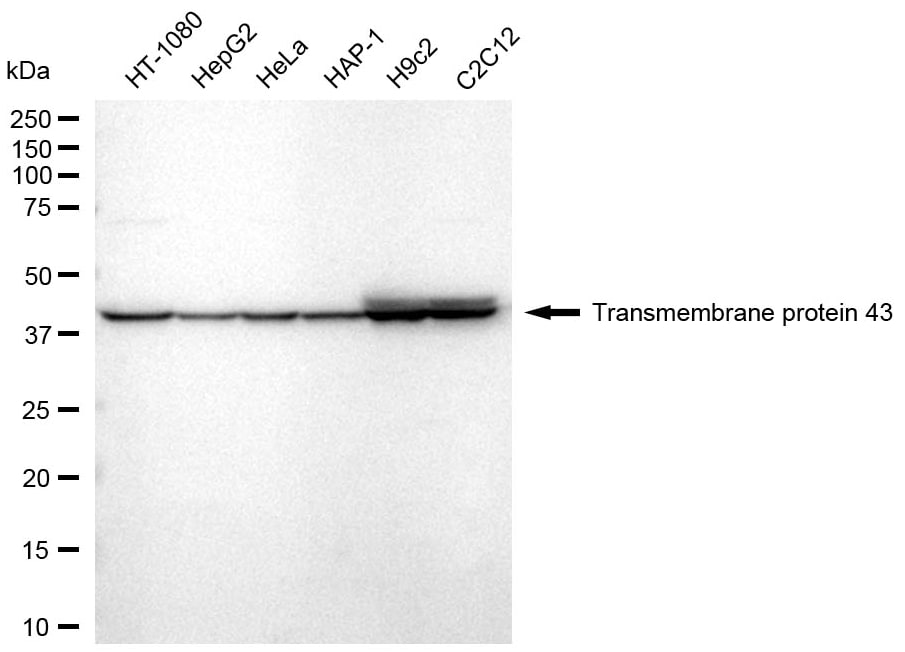 TMEM43 Antibody (24GB2325)