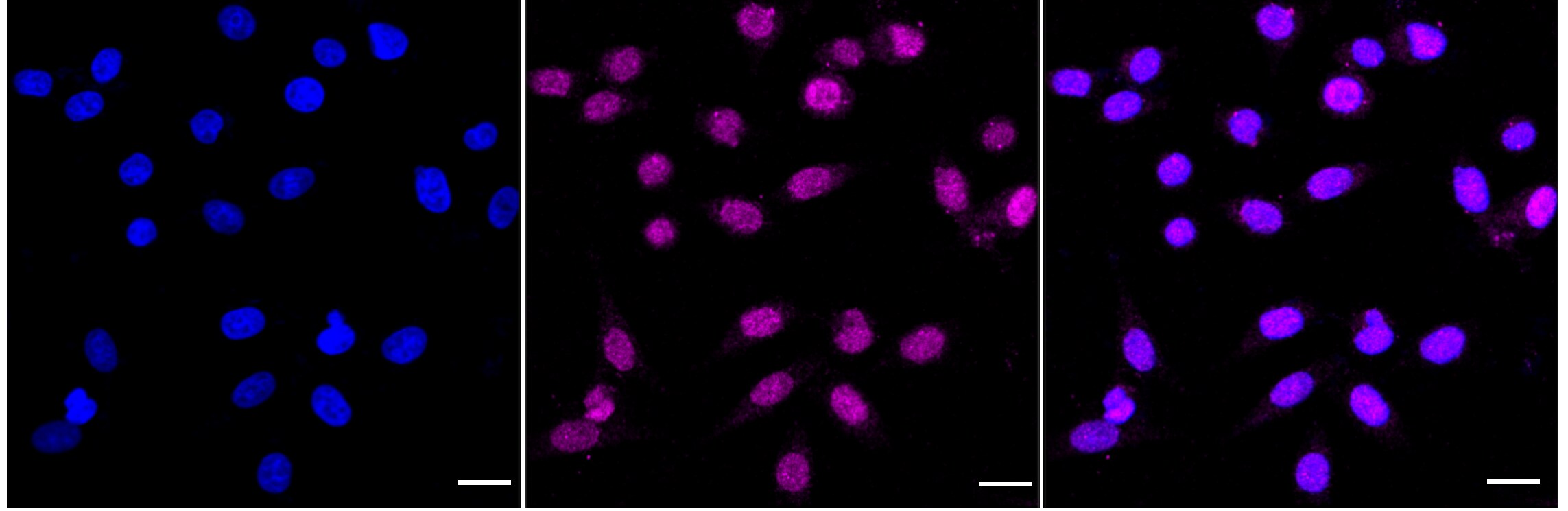 ATE1 Antibody (24GB4720)