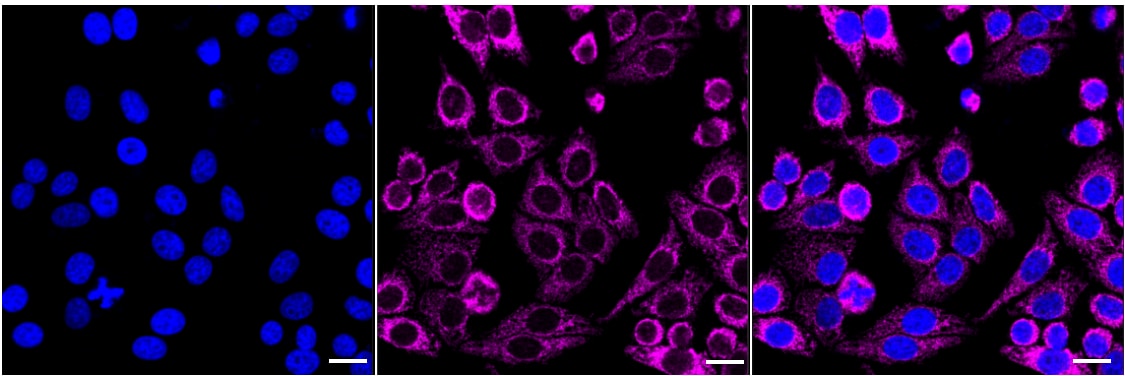 Versican Antibody (24GB2380)