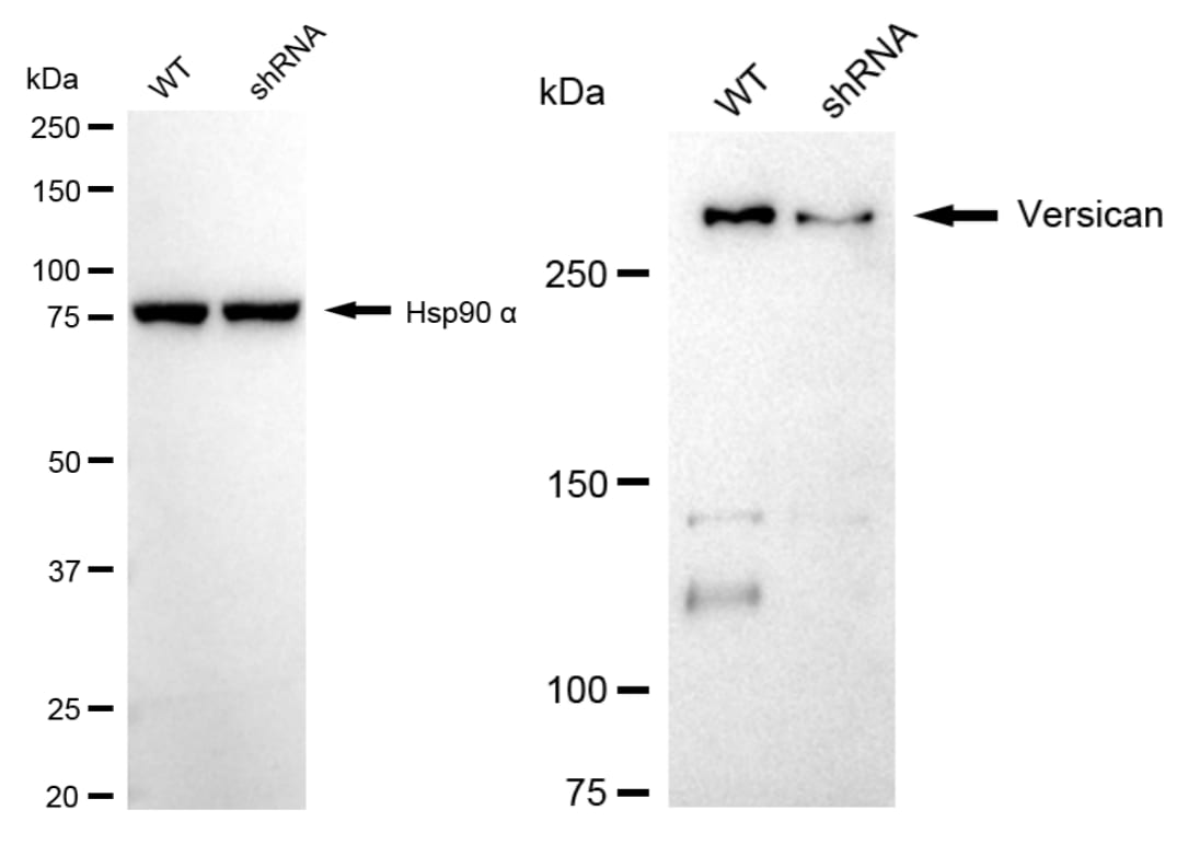 Versican Antibody (24GB2380)