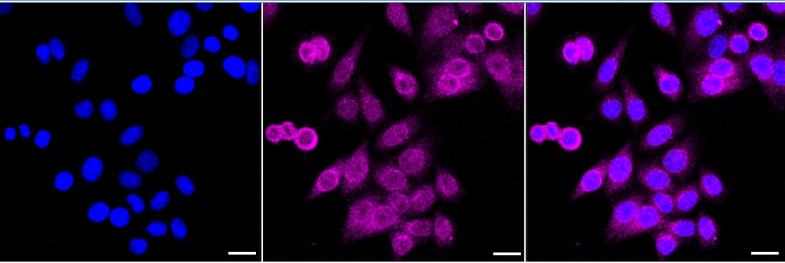 TREX1 Antibody (24GB2440)