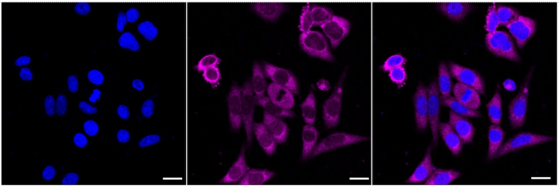 UNG Antibody (24GB2530)
