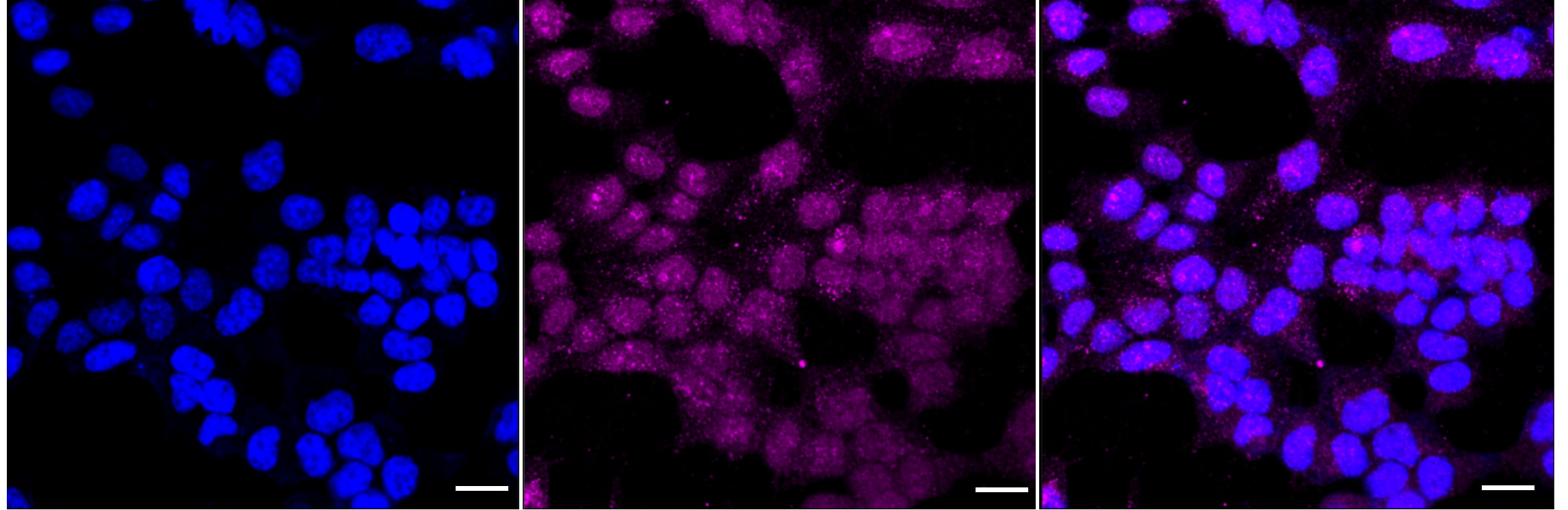 5T4 Antibody (24GB1990)