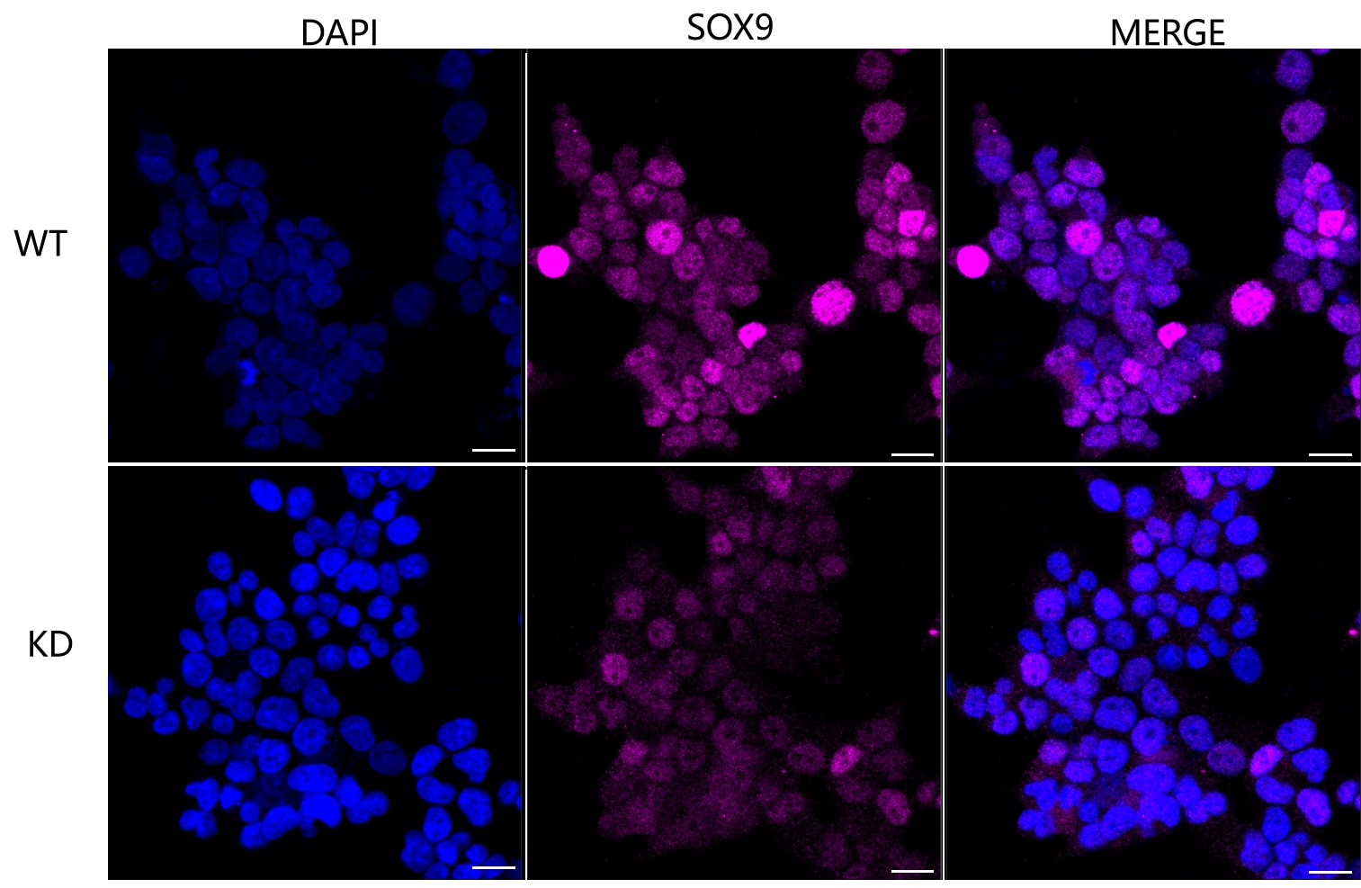 SOX9 Antibody (24GB2000)