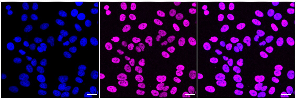 TRBP Antibody (24GB2425)