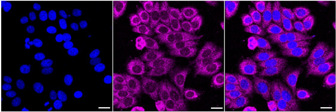 UQCRFS1 Antibody (24GB2460)
