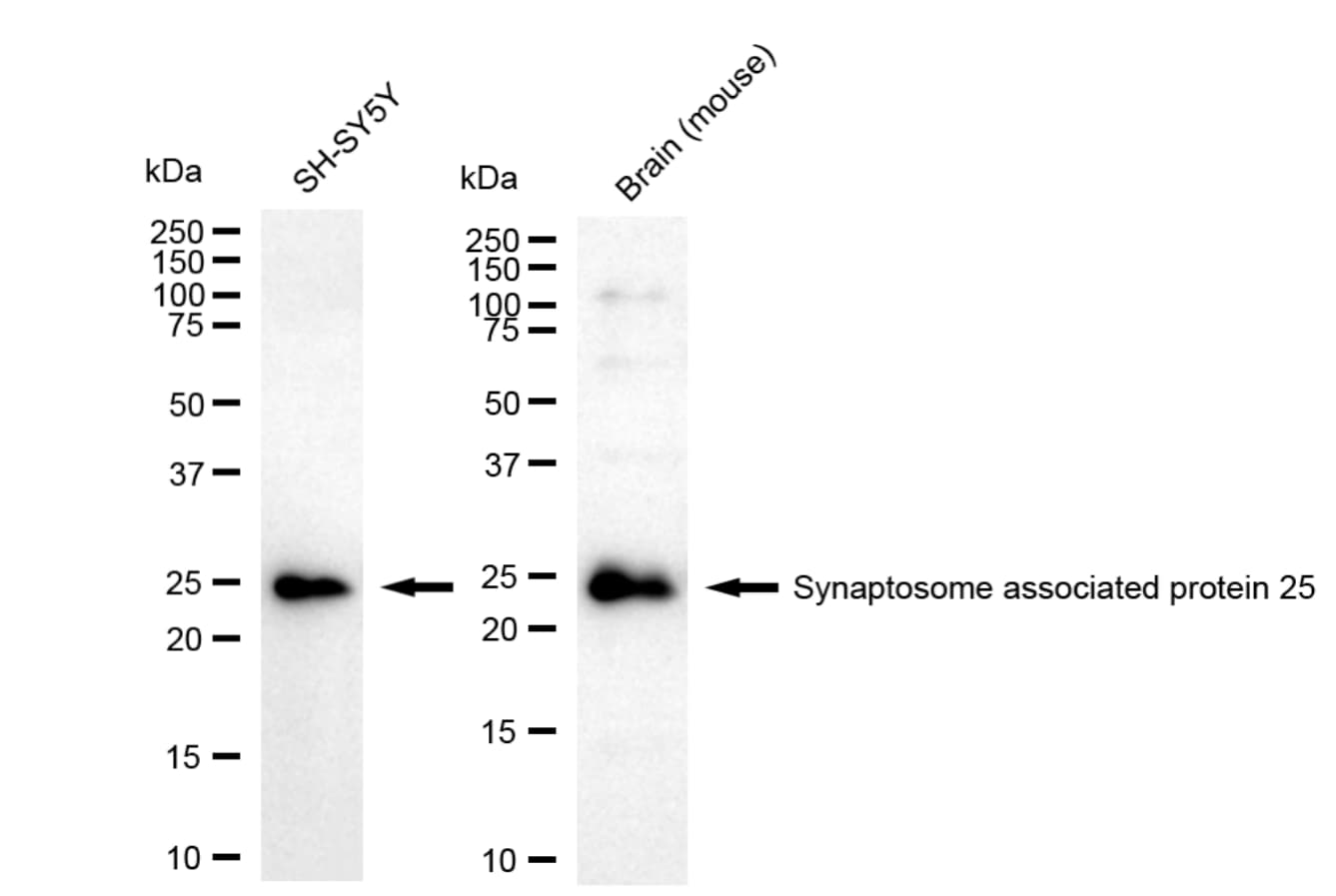 SNAP25 Antibody (24GB2640)