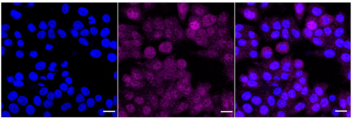 ZNF259 Antibody (24GB1805)