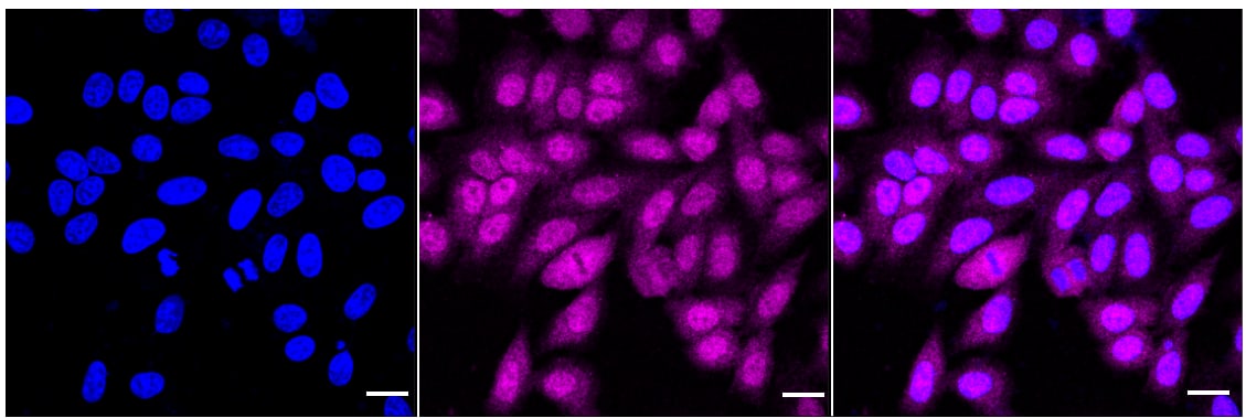 UbcH7/UBE2L3 Antibody (24GB1875)