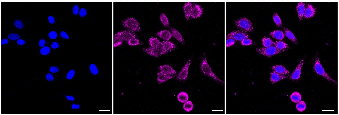 VAP-A Antibody (24GB2580)