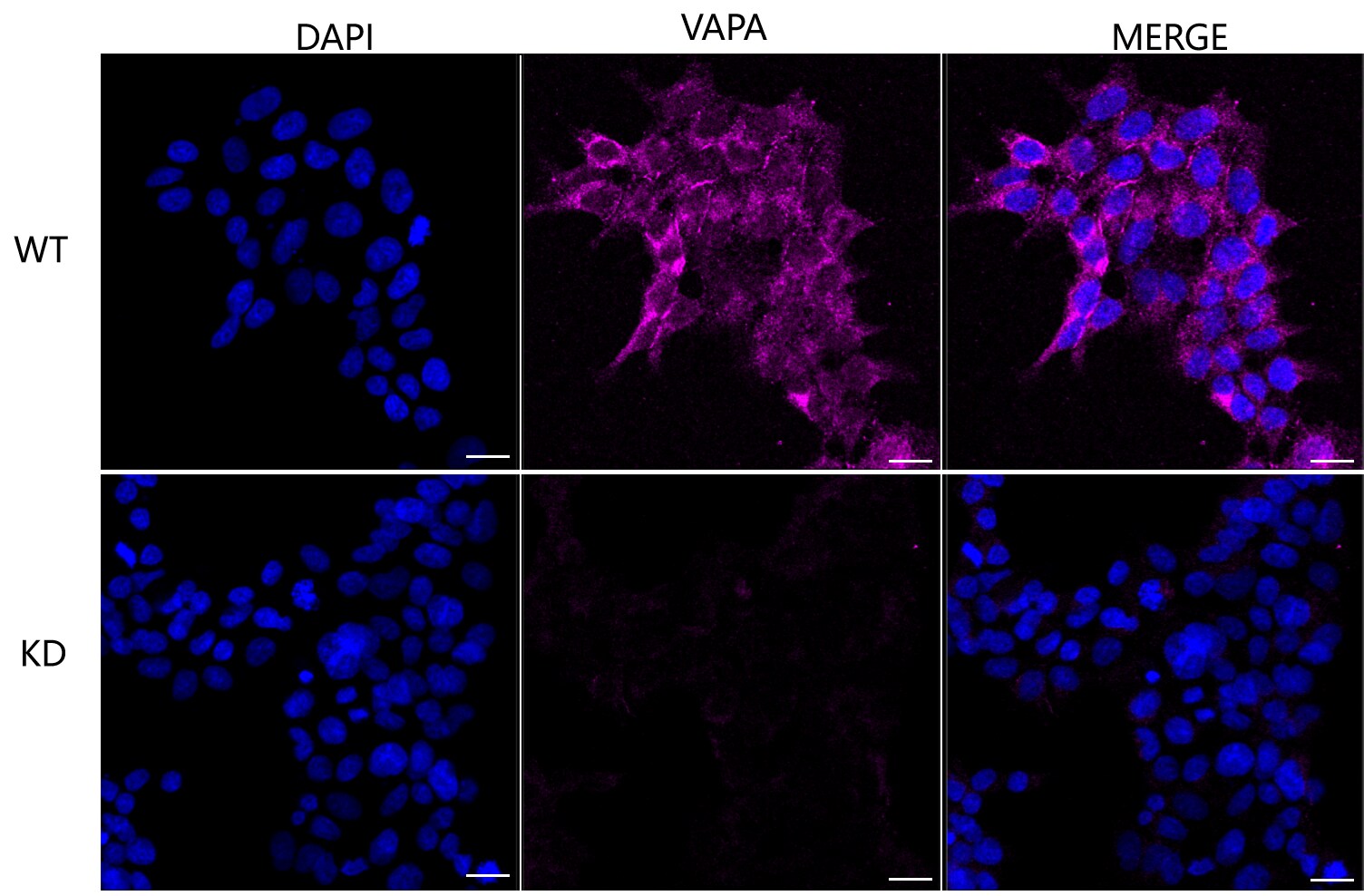 VAP-A Antibody (24GB2580)