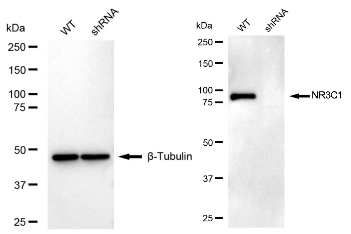 GR/NR3C1 Antibody (24GB2760)