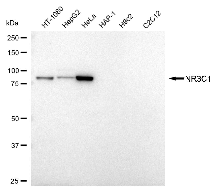 GR/NR3C1 Antibody (24GB2760)